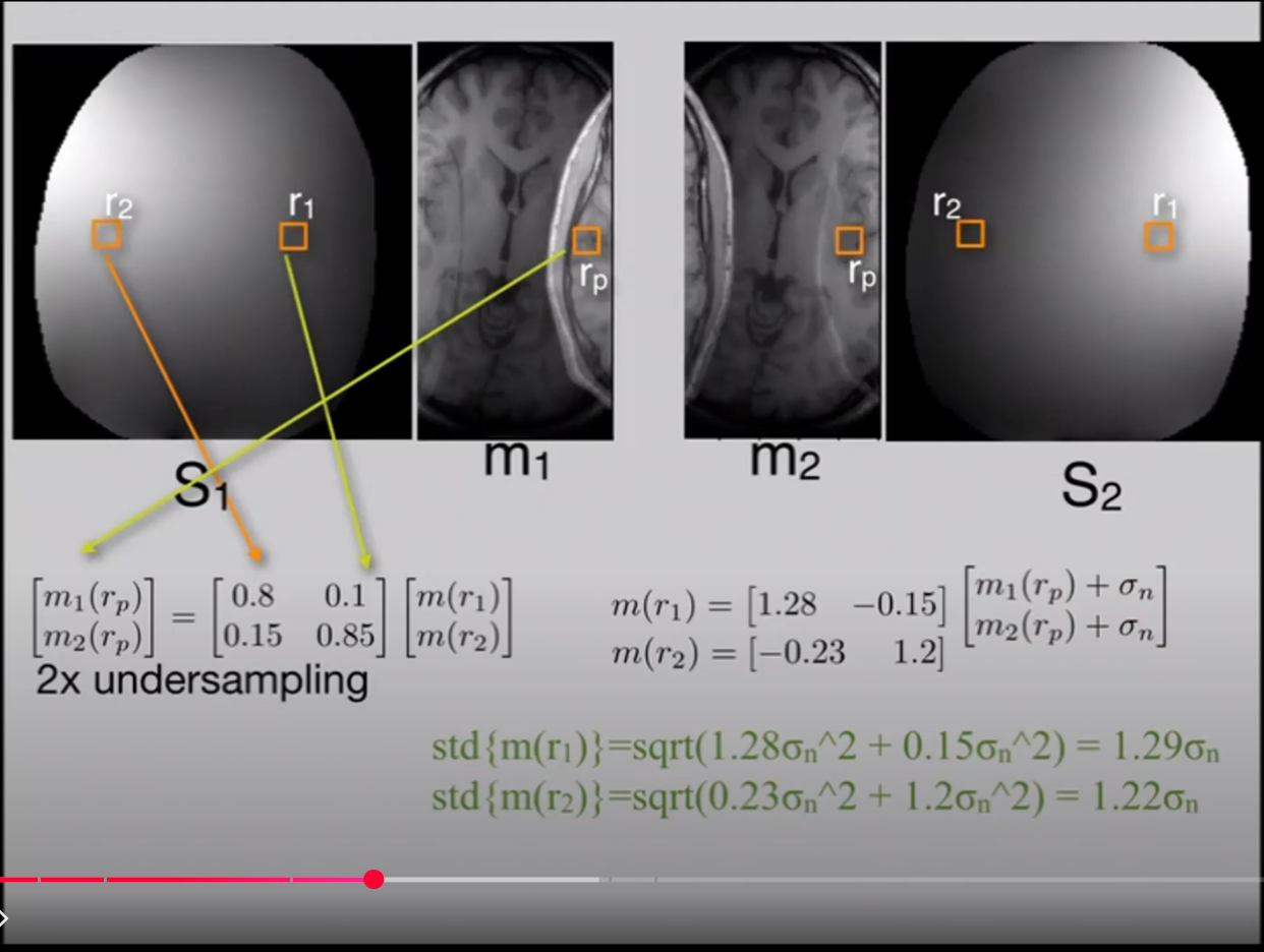 2x Undersampling